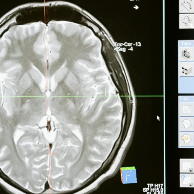 Can Stonehenge Health Dynamic Brain Support Brain Health