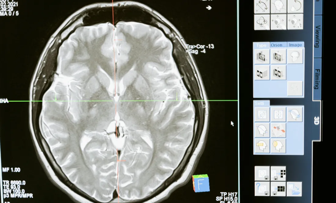 Can Stonehenge Health Dynamic Brain Support Brain Health